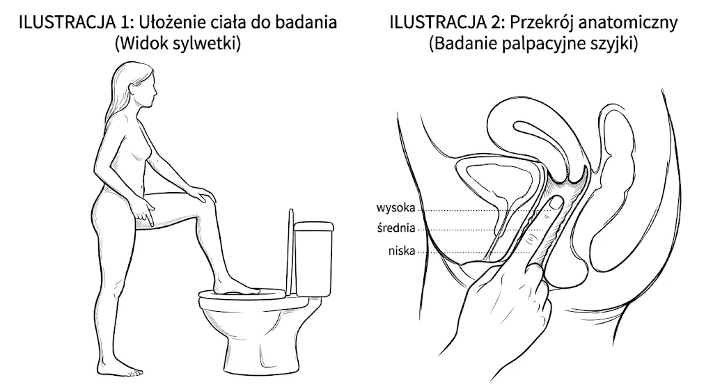 Pozycja do badania i przekrój anatomiczny