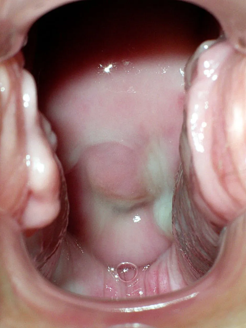 14–23 dni cyklu